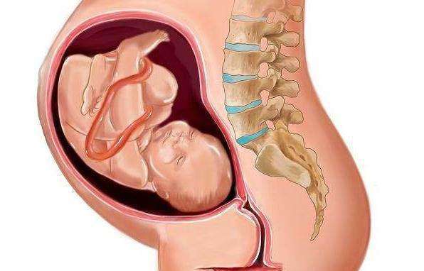 胎儿半入盆和全入盆有什么不同,胎儿入盆和没入盆肚子的图片对比