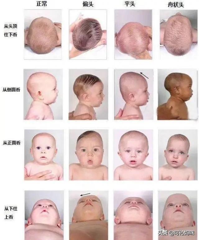 宝宝会从圆脸变成方脸吗,宝宝脸大能变成瓜子脸吗