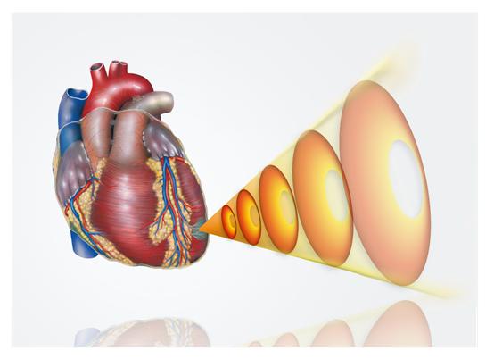 北京医院心内科何青,体外心脏震波技术治疗冠心病