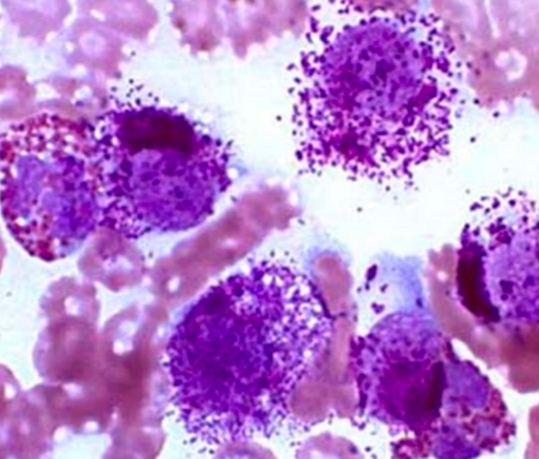 猫咪耳廓有个鼓包是怎么回事,猫咪耳根部长了个大包