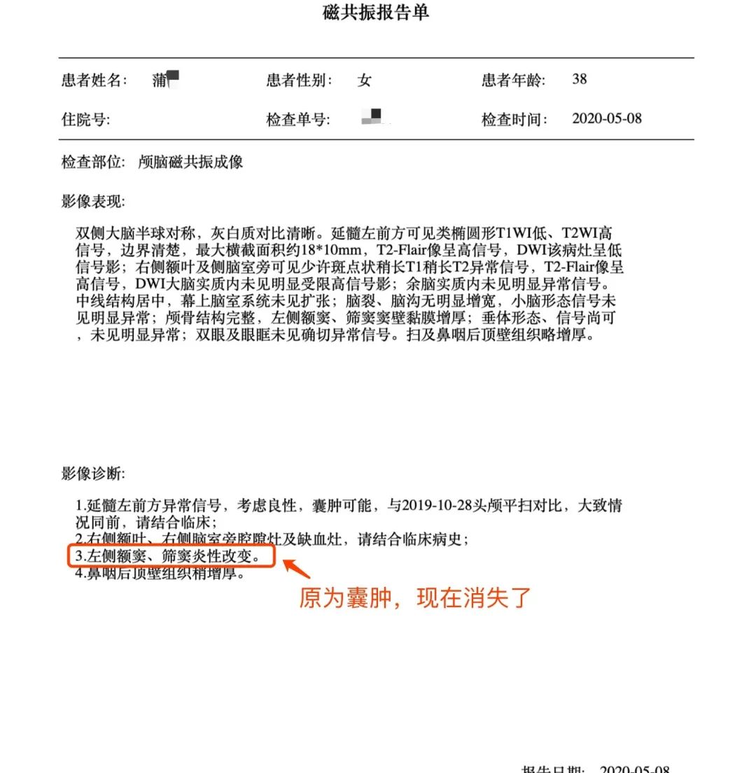 凤鸣医案|吃了20付中药，囊肿消失了