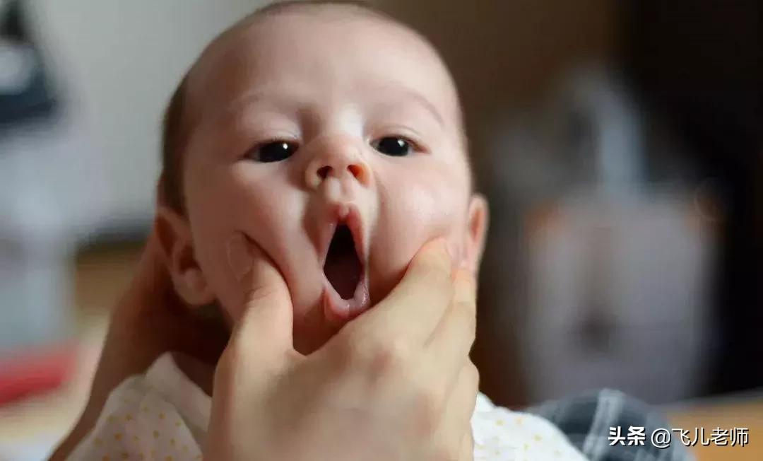 捏宝宝的脸蛋口水会变多吗,宝宝口水疹快速消除小妙招