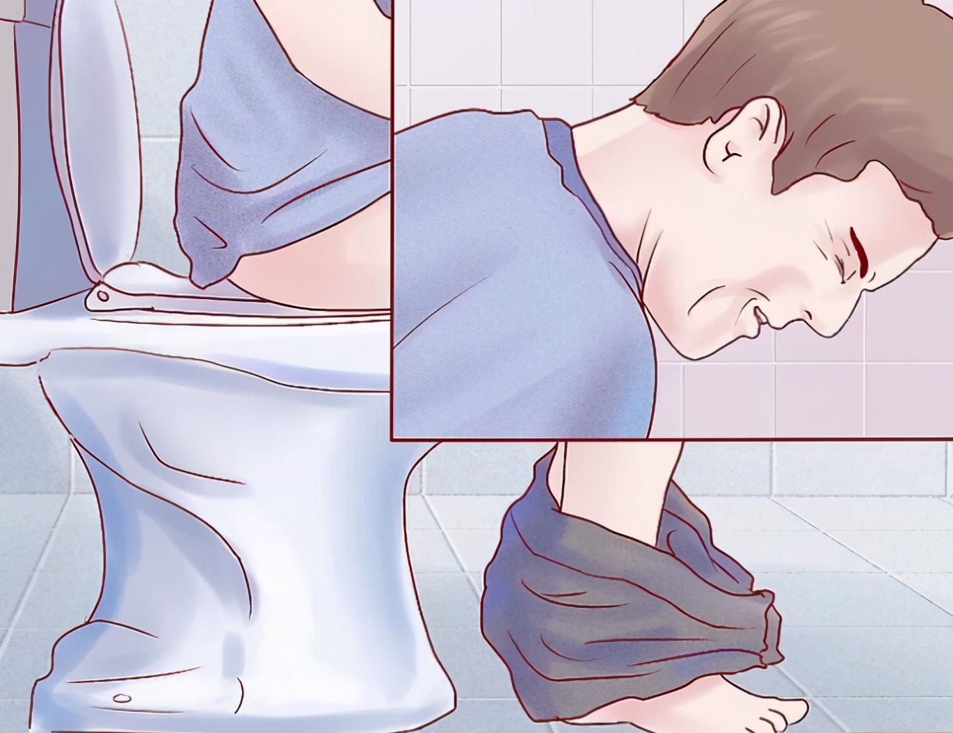 胡适怎么治疗痔疮,什么是痔疮