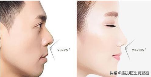 隆鼻也分性别，男女隆鼻差异知多少？