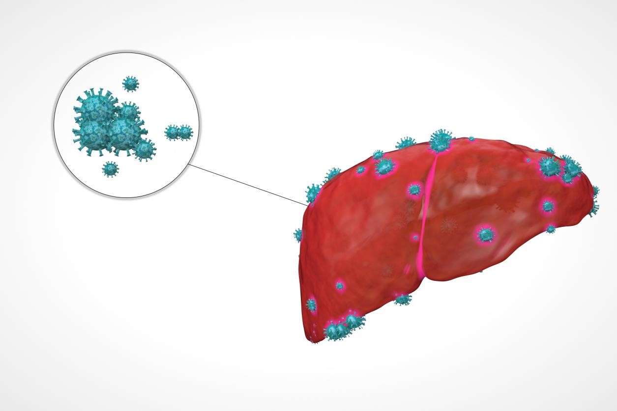 乙肝转阴的真实例子,乙肝说的转阴是什么意思