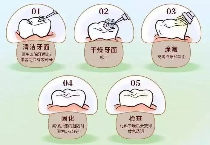 认真刷牙、不吃糖的娃竟得了10颗蛀牙，只因家长疏忽了这4点