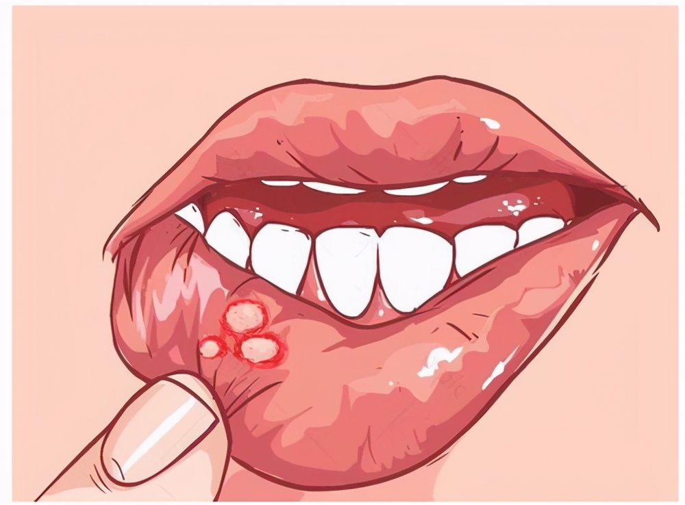 “嘶，好疼！”有一种病，很多人会得，但治疗方法却总用不对