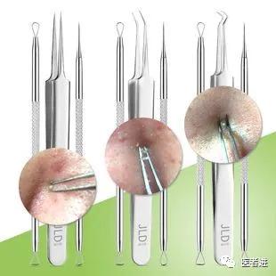 长痘痘后要怎么处理,长痘痘后怎么处理