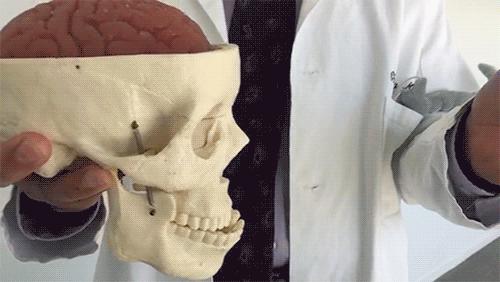 脑震荡是什么原因,得了脑震荡是怎么回事