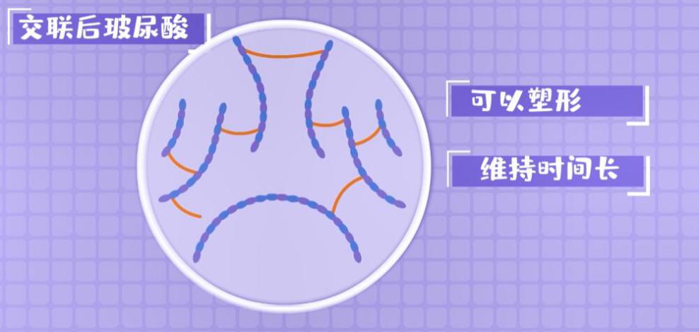 玻尿酸比较好的,好的玻尿酸成分表
