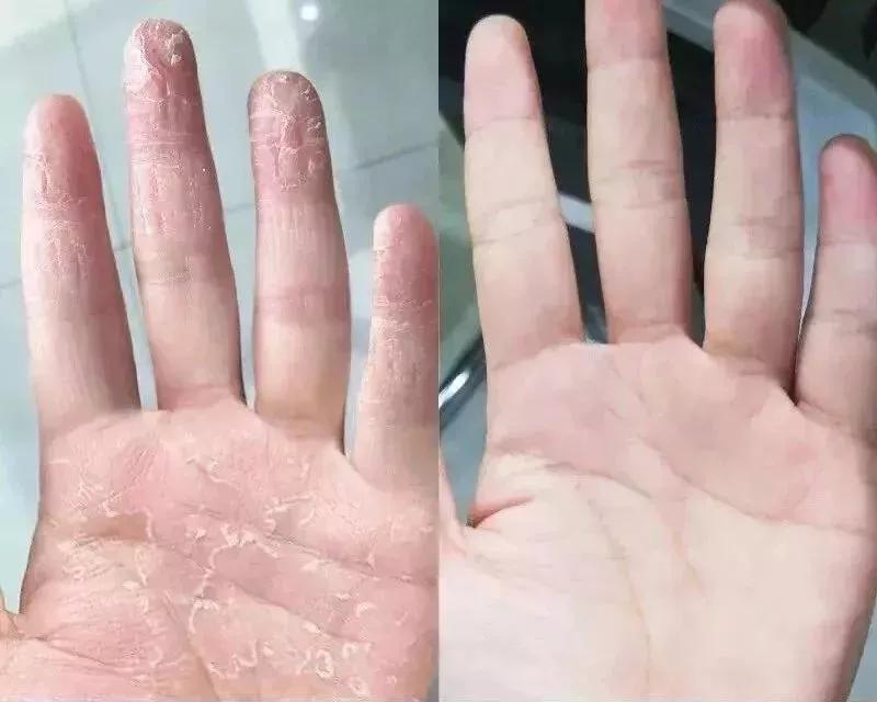 祛除角质细纹的护手霜,干裂护手霜秋冬季