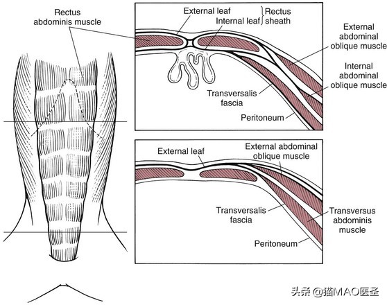 猫咪腹膜炎就是腹水吗,猫咪腹膜炎和传染性腹膜炎的区别