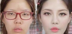 近视眼镜会不会影响颜值,眼睛近视了会影响颜值吗