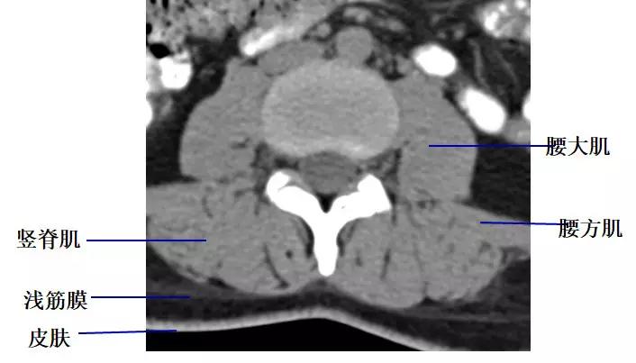 颈椎腰椎疾病ct及mri诊断,腰椎ct可以发现肠部病变吗
