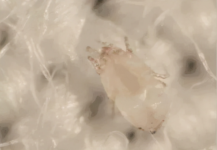 如何去除被窝里的螨虫,什么妙招祛除螨虫