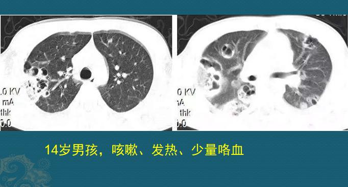 路边的野店不要去，花钱多，有些针还伤身体……