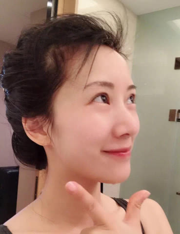 用了成百上千张化妆棉，皮肤却越来越薄了，原来是打开方式不正确