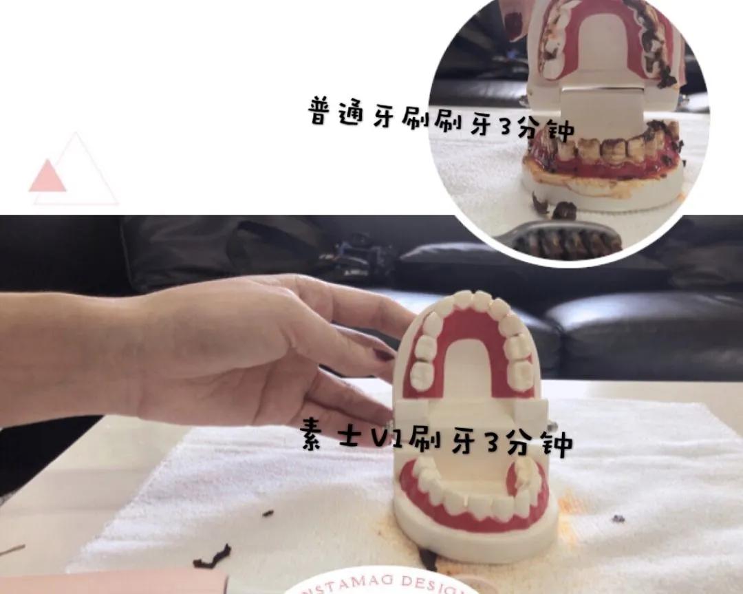 旋转式电动牙刷和声波式电动牙刷,智能成人电动牙刷声波洁牙神器