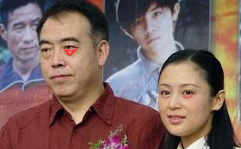 如何消除眼袋拥有卧蚕,眼袋和眼纹哪个好去除