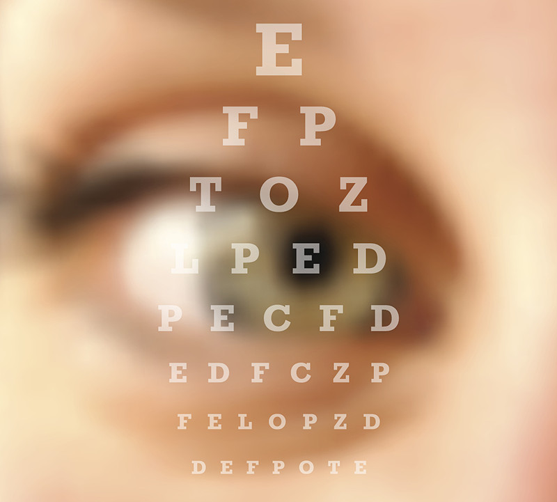 看电脑眼睛变熊猫眼,高度近视诱发白内障