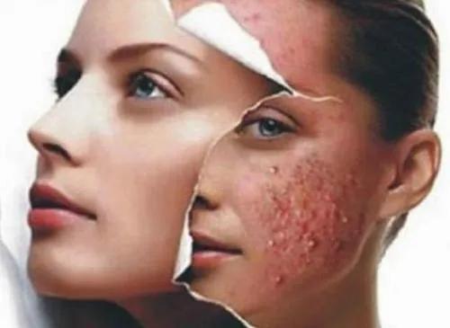 居家护肤就可以？为什么越来越多人离不开美容院？