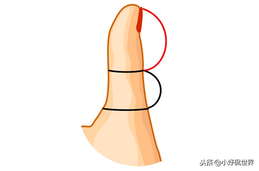 5种指型图,不同大拇指的形状代表什么