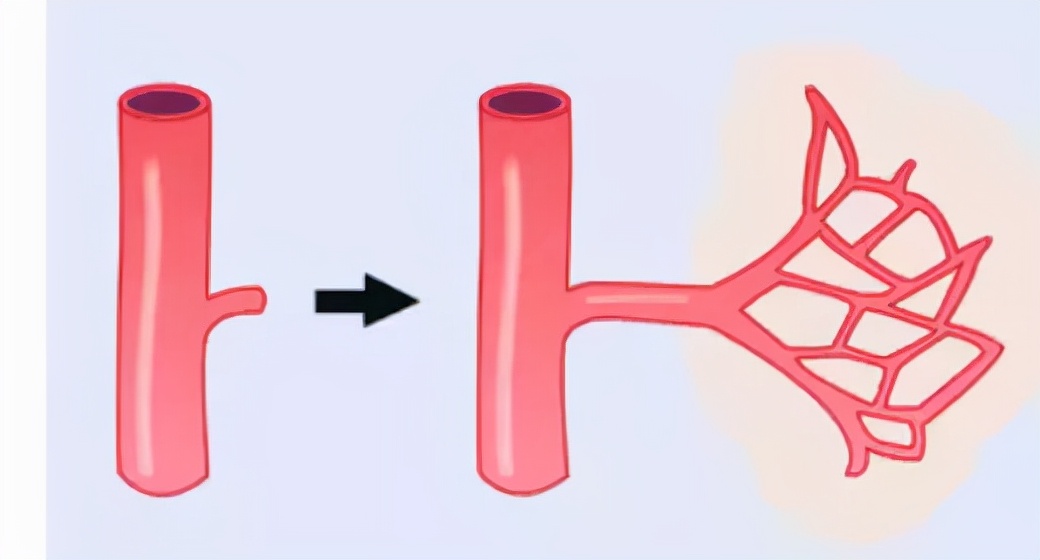 怎样判断脑血管侧支循环是否良好,有勇有谋是优点吗