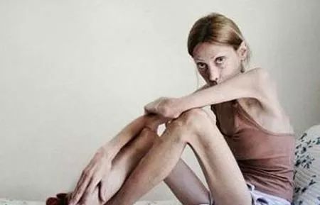 女模特去世时23斤,女模特去世身体只有23斤