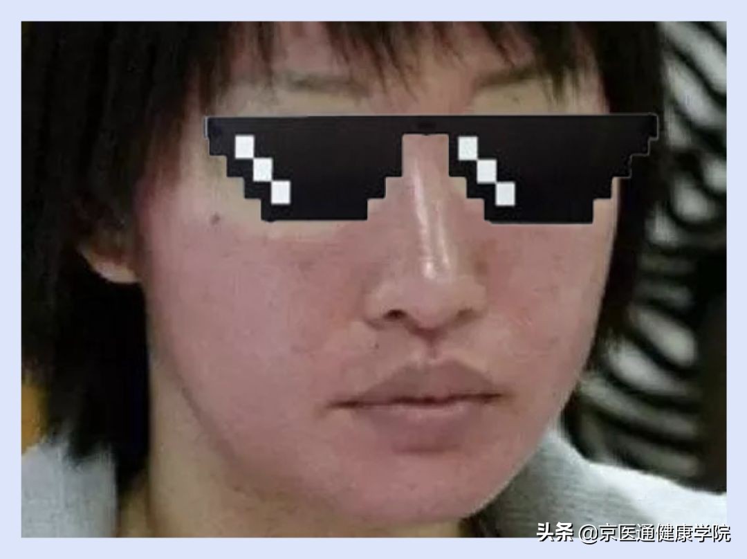 菲洛嘉打多了会怎么样,菲洛嘉一般多少钱可以打