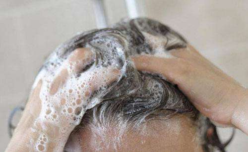 头皮屑最简单的解决方法,头皮屑的原因及解决方法