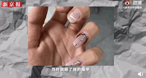 张培萌妻子谈被家暴,张培萌妻子首谈家暴细节全视频