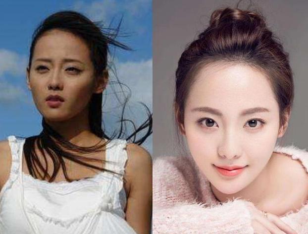 女人为什么不能打美白针,千万别打美白针真的会要人命