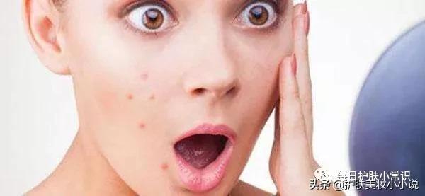 毛孔粗大有痘印如何改善女生,痘印毛孔粗大油皮如何消除