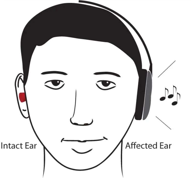 听障人士怎么才能听到音乐,听障人士怎么才能听音乐