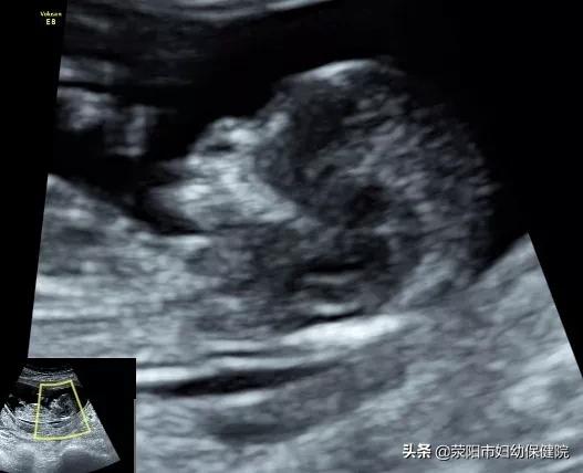 新冠后备孕检查,孕妇新冠诊疗手册