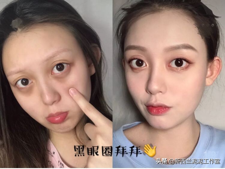 吴昕同款祛黄脸,吴昕眼袋