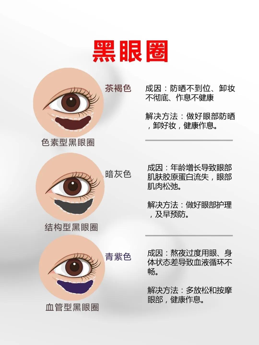 黑眼圈眼袋脂肪粒怎么去除,黑眼圈有纹有脂肪粒用什么