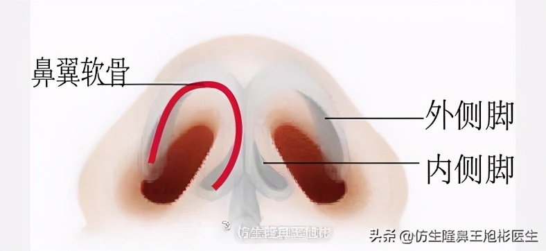 大鼻头能做直鼻微翘吗,可以只做鼻头缩小术吗