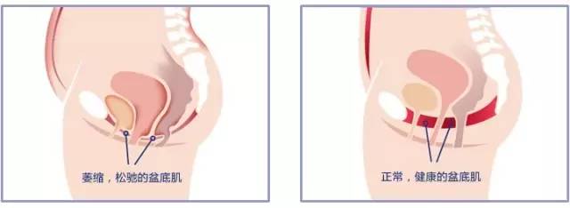 10个黄金动作帮助产后恢复,一般产后恢复做什么项目