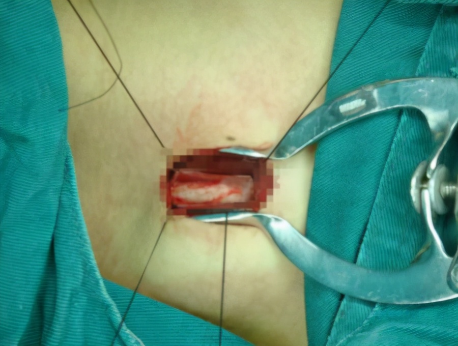 改善言语及认知药,改善记忆力的言语