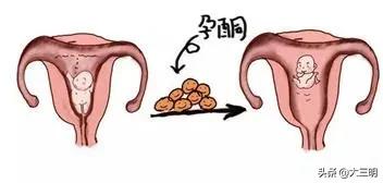 【孕期科普】一次讲清:HCG、孕酮和流产的“三角关系”