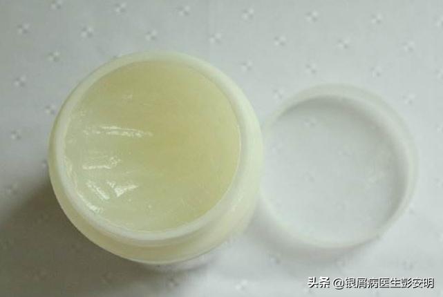 凡士林西瓜霜治白癫风,银屑病西瓜霜和凡士林