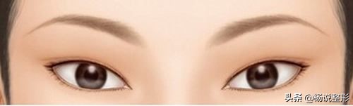 割双眼皮一定好看吗,割双眼皮真的好看吗