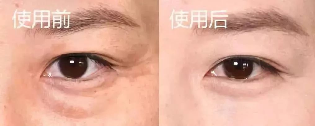 口罩一戴素面朝天,口罩一戴立马漂亮