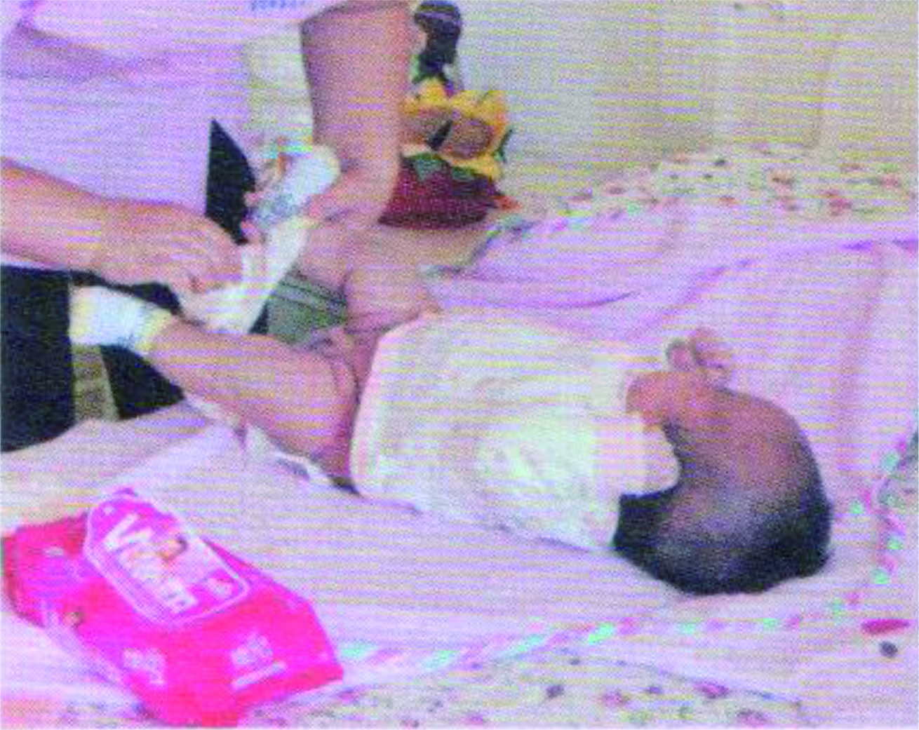 婴幼儿大小便的照顾与清洁实操,婴儿大小便照料照片