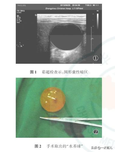 儿童消化道异物处理,小孩吃了耳环塞异物怎么办