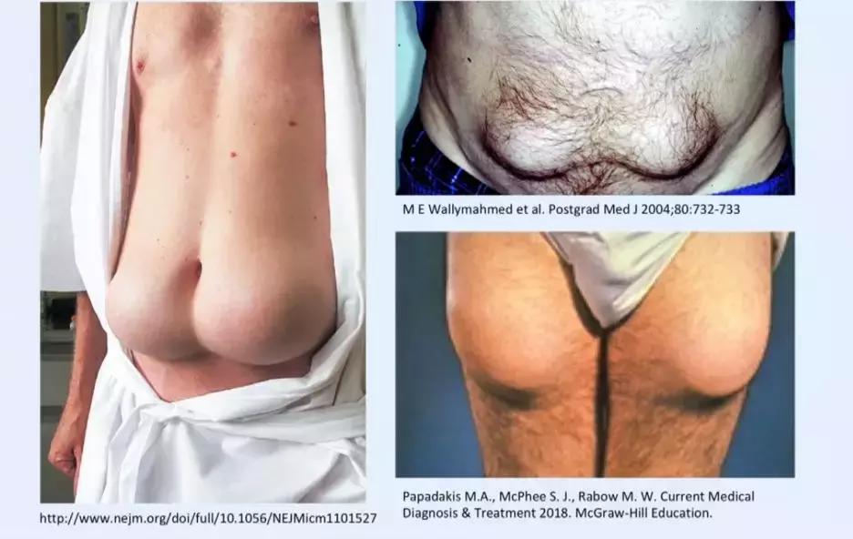 世界公认减肥2天瘦10斤,日本快速减肥法一星期瘦十斤