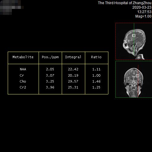 漳州市第三医院预约做磁共振,3.0t核磁共振广东哪里可以做