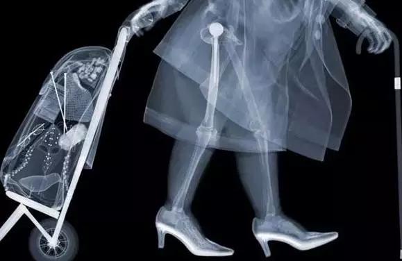 x光b超ct核磁共振区别,收藏这篇就够了