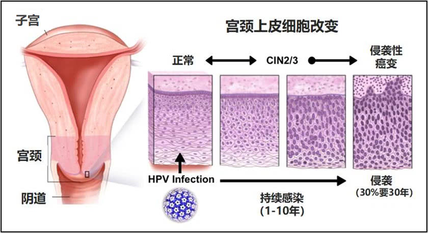 修女为什么容易得乳腺癌,为什么修女寿命短